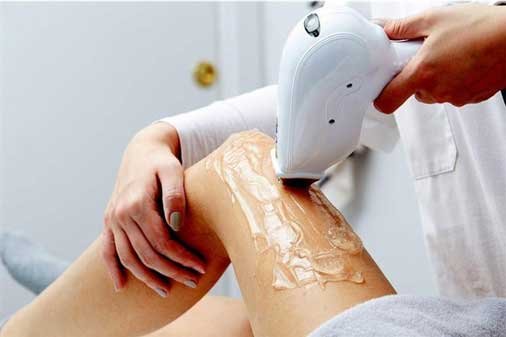 lazer-epilasyon-web-size